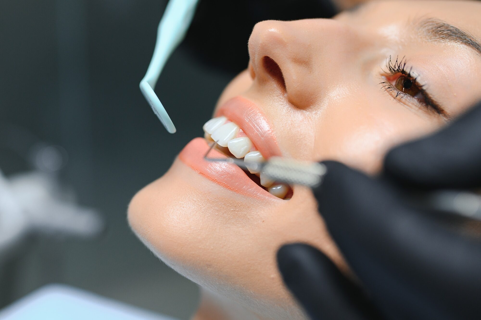 Doctor examining patient's teeth, closeup. Cosmetic dentistry
